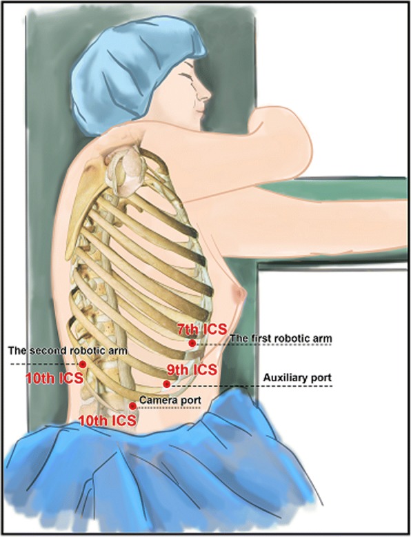 Fig. 2