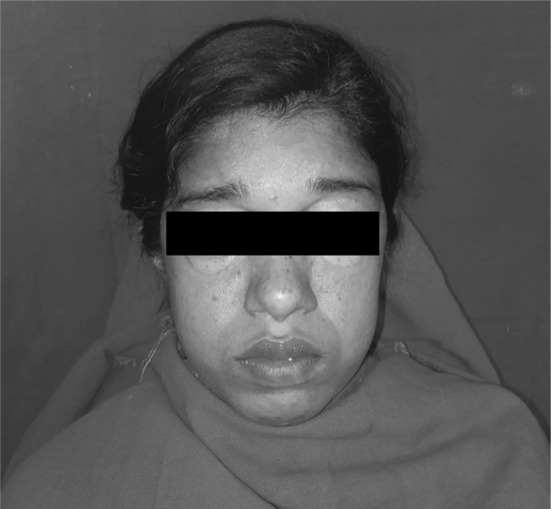 Fig. 2