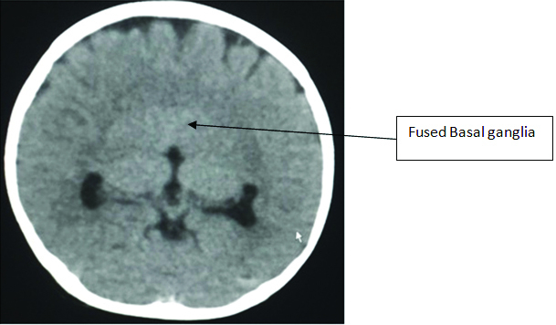 [Table/Fig-3]: