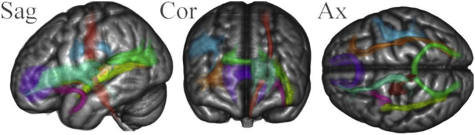 Fig. 1