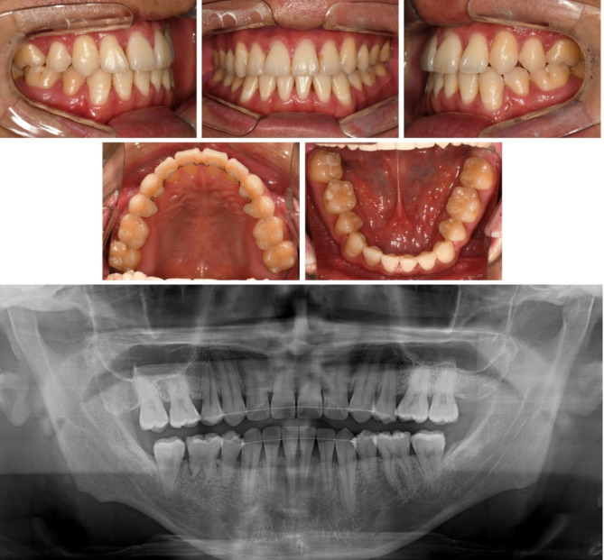 Fig. 13