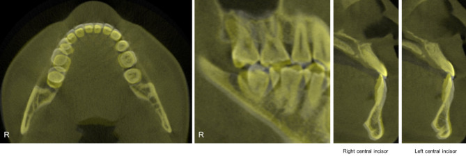 Fig. 10