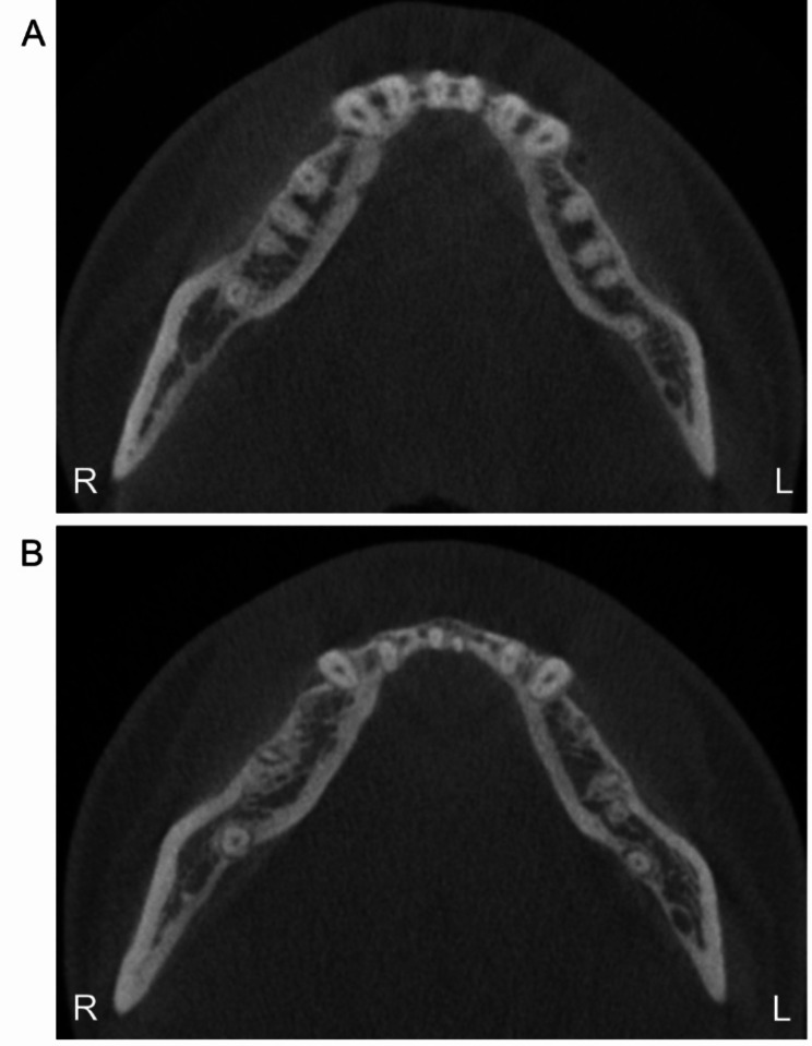 Fig. 11