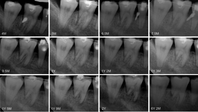 Fig. 6