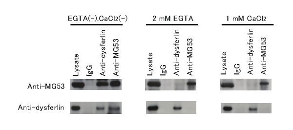 IP assay of dysferlin and MG53.