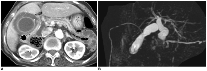 Fig. 14