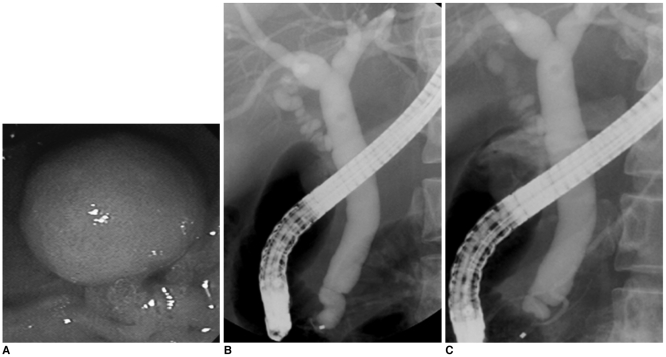 Fig. 12