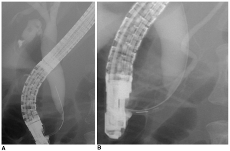 Fig. 11