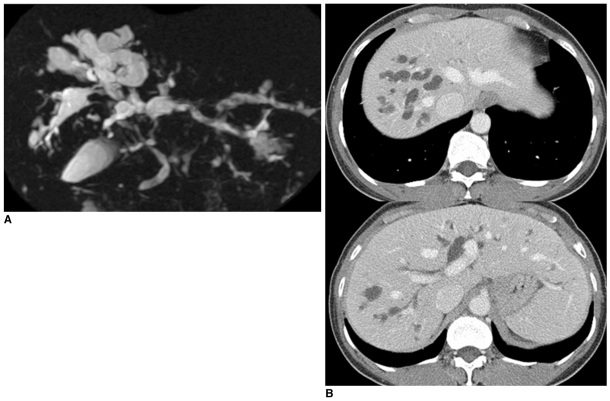 Fig. 13