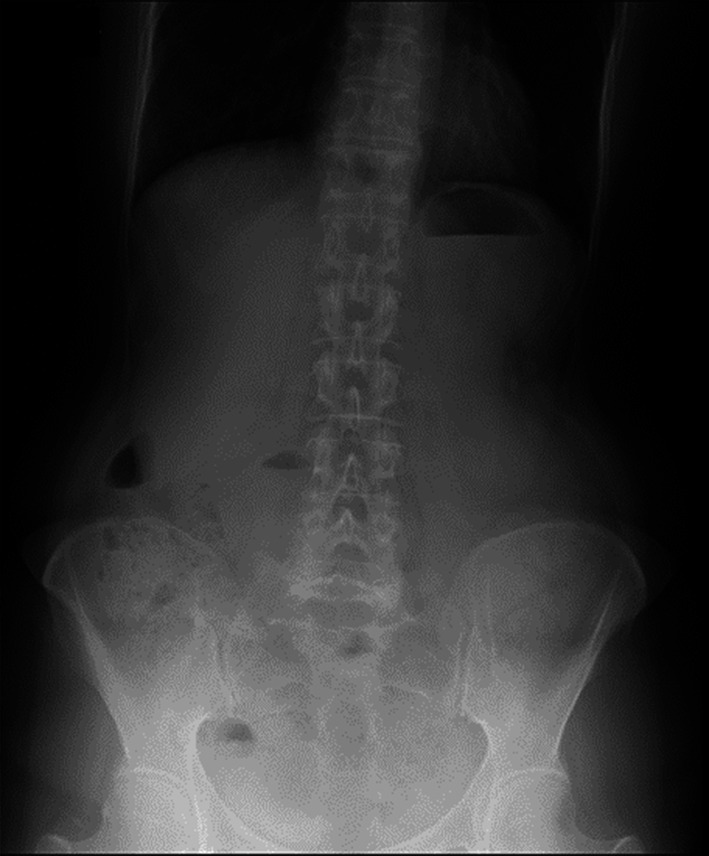 Fig. 1
