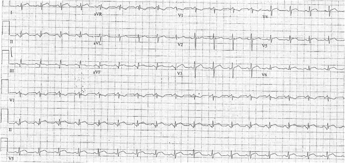 Online Fig. 1