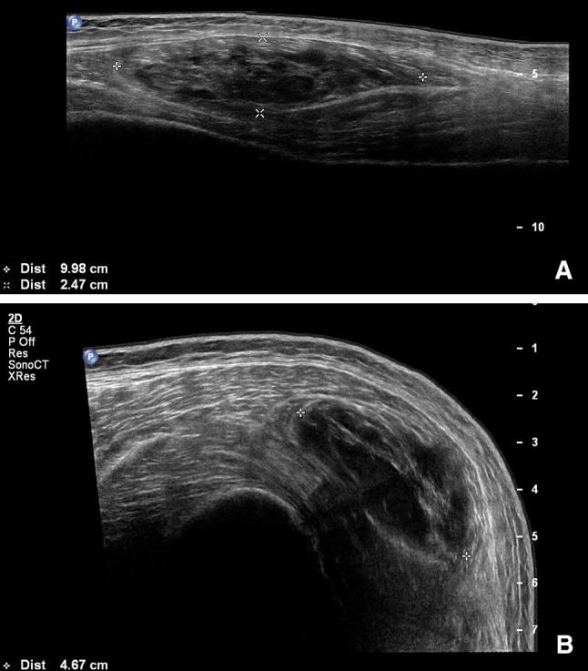 Fig. 2