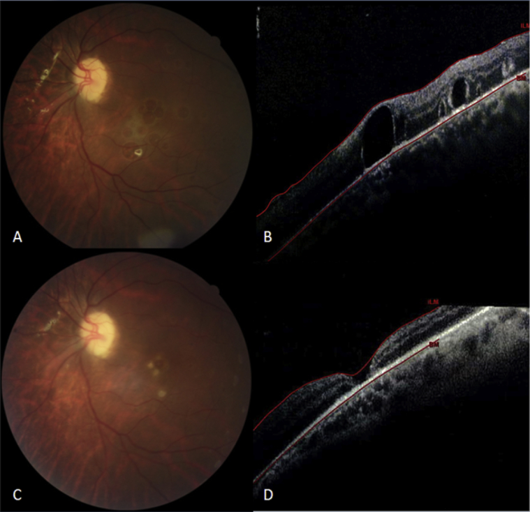 Fig. 3