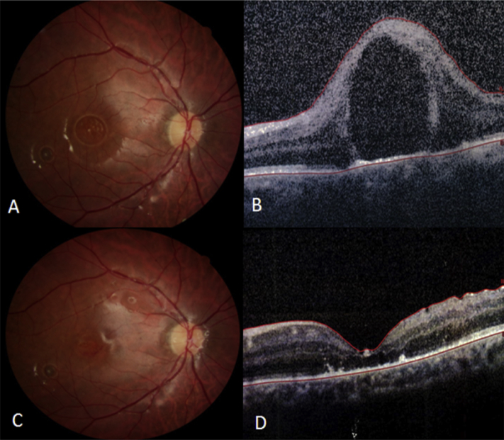 Fig. 1