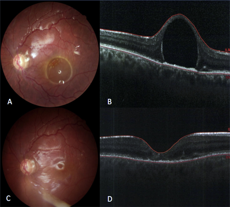 Fig. 2