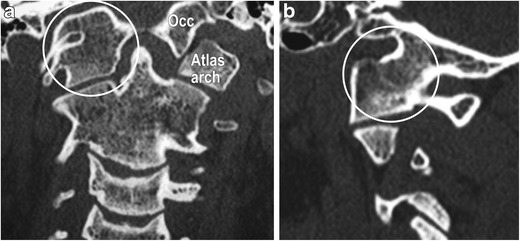 Fig. 13