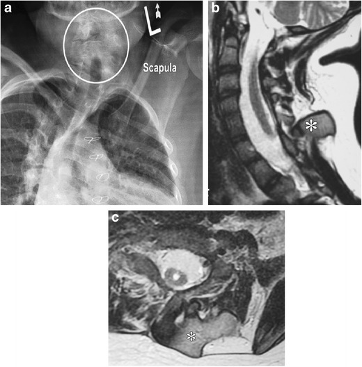 Fig. 11