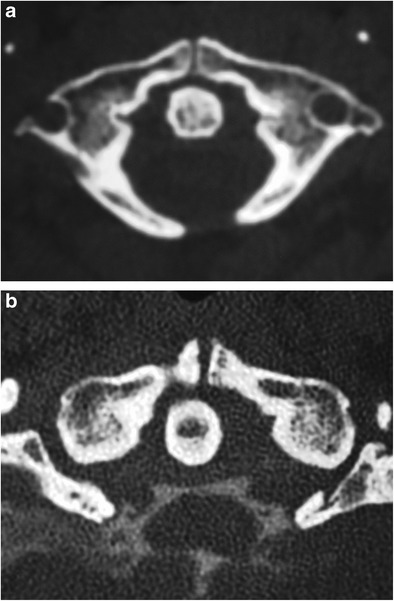 Fig. 16