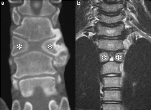 Fig. 12