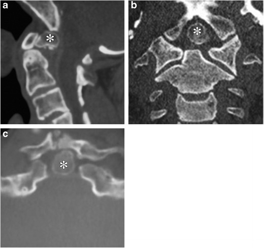 Fig. 14