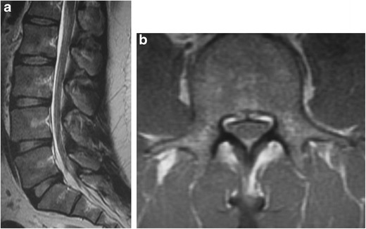 Fig. 17