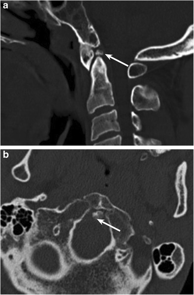 Fig. 15