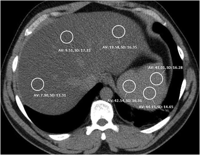 Fig. 2