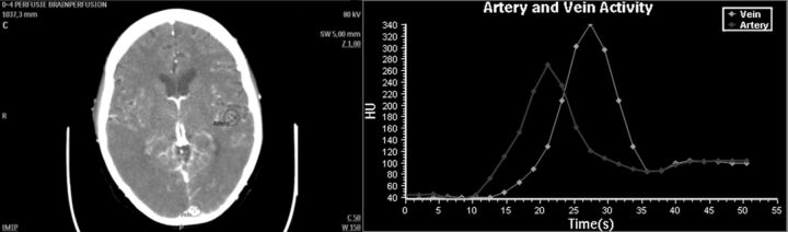 Fig 1.