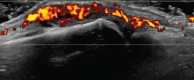 Figure 11.