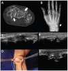Figure 16. A-F.