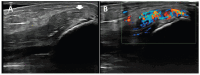 Figure 12. A, B.
