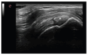 Figure 17.