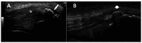 Figure 7. A, B.
