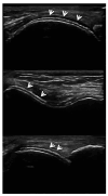 Figure 13.