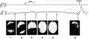 Figure 6