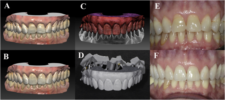 Figure 1