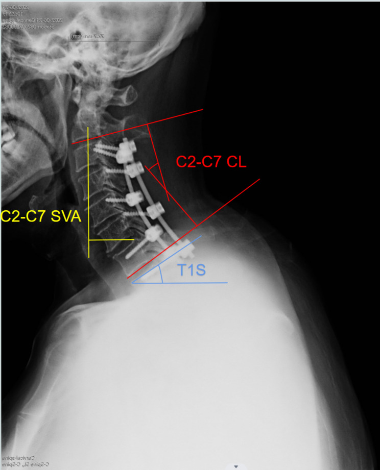 Fig. 3