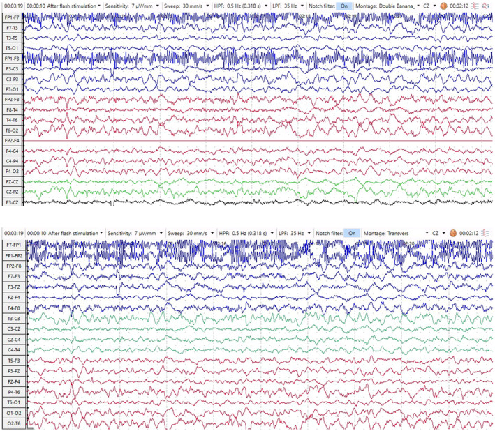 FIGURE 2