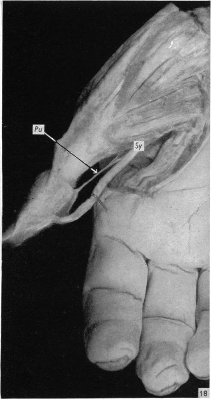 Fig. 18