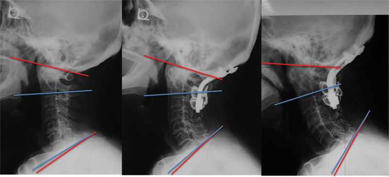 Fig. 7