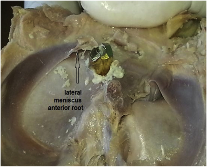 Fig. 3