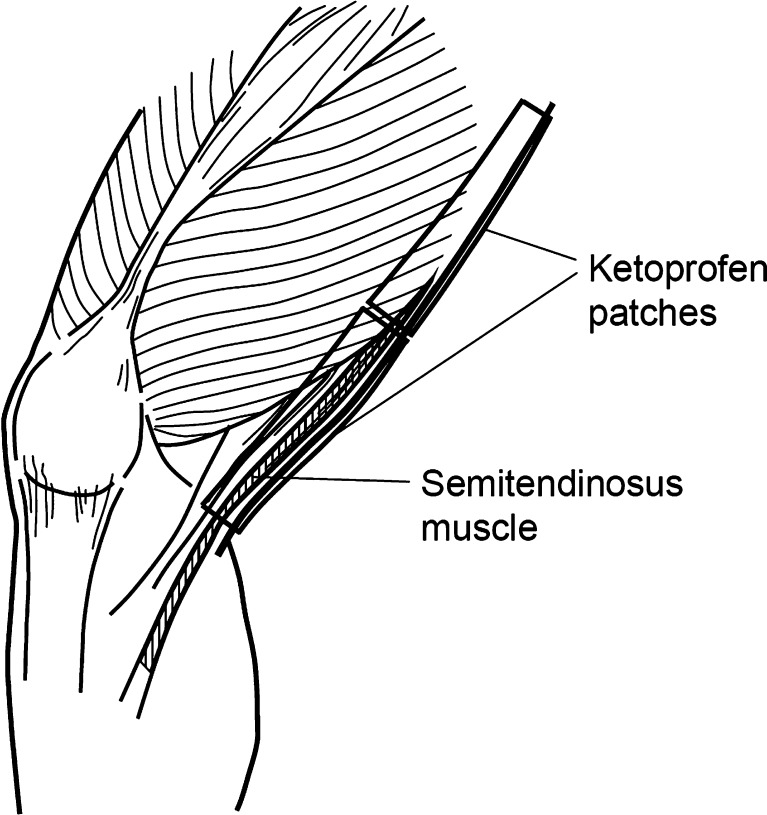 Fig. 1
