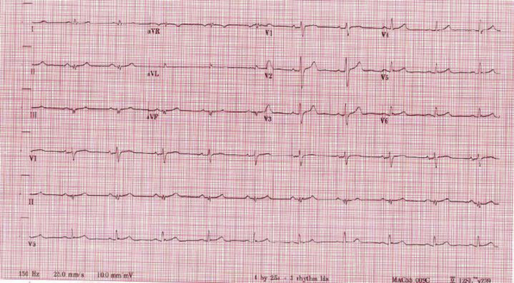 Figure 2