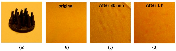 Figure 14.