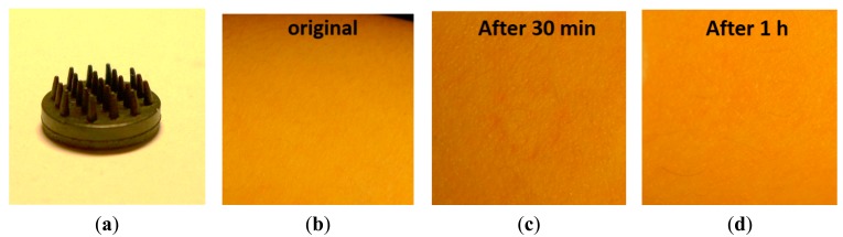 Figure 13.