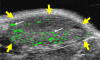 Figure 3b: