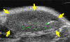 Figure 3a: