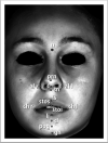 Figure 2. Anthropometric landmarks of soft tissue. n, indicates nasion; prn, pronasale; sn, subnasale; all-alr, left and right alare; c, columella; ls, labiale superius; stos, stomion superius; stoi, stomion inferius; li, labiale inferius; chr-chl, left and right cheilion; sl, sublabiale; pog, pogonion; gn, gnathion.