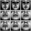Figure 3. Linear measurements of soft tissue. (1) Total face height (n-gn). (2) Upper face height (n-stos). (3) Lower face height (sn-gn). (4) Upper lip height (sn-stos). (5) Upper vermillion height (ls-stos). (6) Lower vermillion height (stoi-li). (7) Lower lip height (stoi-gn). (8) Mouth width (chr-chl). (9) Nasal width (alr-all).