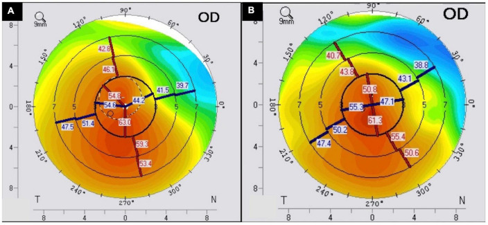 FIGURE 3